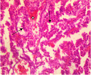 Image for - Growth Response, Serum Biochemistry and Organ Histopathology of Broilers Fed Diets supplemented with Graded levels of Petiveria alliacea Root Meal