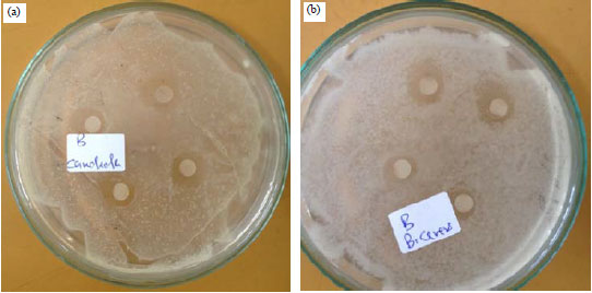 Image for - Evaluation of the Antibiotic Properties of Probiotics and their Efficacy on Performance and Immune Response in Broiler Chicken