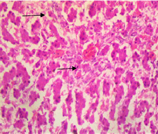 Image for - Growth Response, Serum Biochemistry and Organ Histopathology of Broilers Fed Diets supplemented with Graded levels of Petiveria alliacea Root Meal