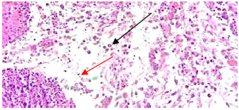 Image for - Pathogenicity of Kenyan Infectious Bursal Disease Virus Isolates in Indigenous Chickens