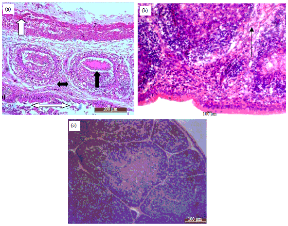 Image for - Scoring System for Lesions Induced by Different Strains of Infectious Bursal Disease Virus in Chicken