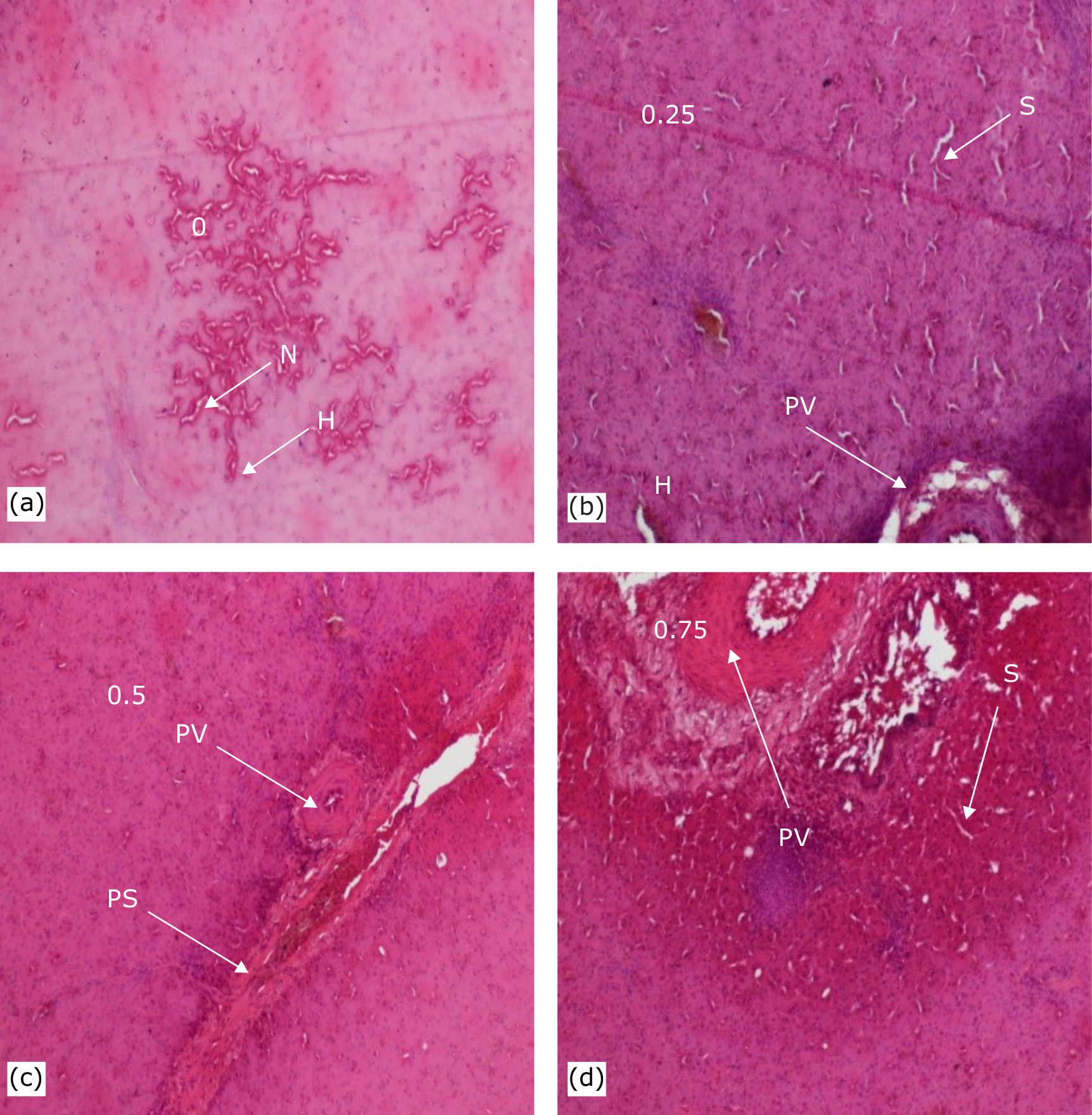 Fig. 1(a-d): Effects of Mangifera indica leaf powder in feed on liver histology in Brahma hen. 0 (control), 0.25, 0.5 and 0.75: Doses of Mangifera indica leaf powder (g), PS: Portal space, H: Hepatocyte, N: Necrosis, S: Sinusoid and PV: Portal vein