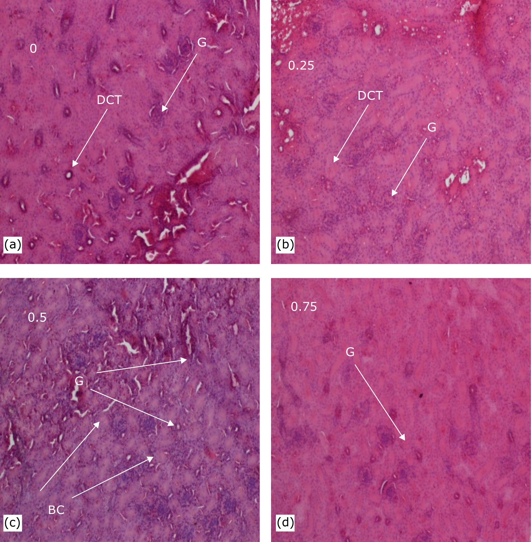 Fig. 2(a-d): Effects of Mangifera indica leaf powder in feed on kidney histology of Brahma hen. 0 (control), 0.25, 0.5 and 0.75: Doses of Mangifera indica leaf powder (g), G: glomerulus, BC: Bowman's capsule and DCT: Distal convoluted tube