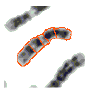 Image for - Evaluation of Standardization of Curve Evolution Based Boundary Mapping Technique for Chromosome Spread Images