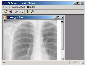 Image for - Comparative Performance Analysis of Image Compression by JPEG 2000: A Case Study on Medical Images