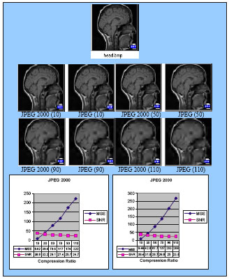 Image for - Comparative Performance Analysis of Image Compression by JPEG 2000: A Case Study on Medical Images