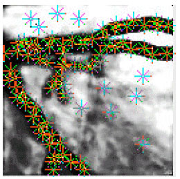 Image for - Backpropagation Network for Segmentation and Blood flow Velocity Determination in Coronary Angiogram Images