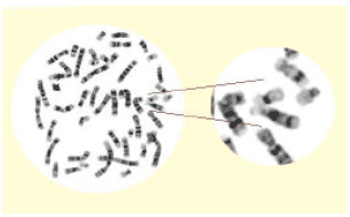 Image for - Unraveling New Strengths in Discrete Cosine Transform Based Gradient Vector Flow Active Contours for Chromosome Image Segmentation