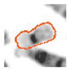 Image for - Unraveling New Strengths in Discrete Cosine Transform Based Gradient Vector Flow Active Contours for Chromosome Image Segmentation