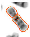 Image for - Robustness in Efficient Chromosome Image Segmentation Using Discrete Cosine Transform Based Gradient Vector Flow Active Contours