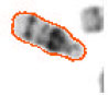 Image for - Robustness in Efficient Chromosome Image Segmentation Using Discrete Cosine Transform Based Gradient Vector Flow Active Contours