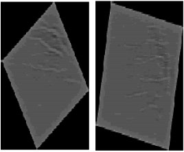 Image for - Vessel Enhancement Using Directional Features