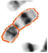 Image for - Novel Findings in Chromosome Image Segmentation Using Discrete Cosine Transform Based Gradient Vector Flow Active Contours