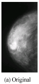 Image for - Novel Segmentation Technique Using Wavelet Based Active Contour Model for Detection of Mammographic Lesions