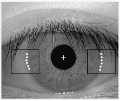 Image for - A New Localization Algorithm for Iris Recognition