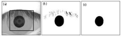 Image for - GVF Snake-based Method for Accurate Pupil Contour Detection