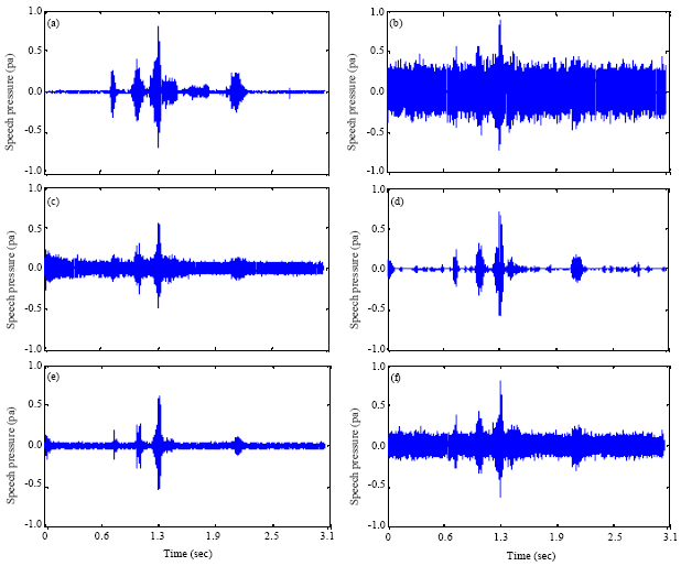 Image for - Improving Whisper Intelligibility in Noise Environment Based on Joint Time Frequency Analysis