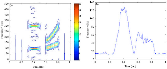 Image for - Kurtosis Based Time-frequency Analysis Scheme for Stationary or Non-stationary Signals with Transients