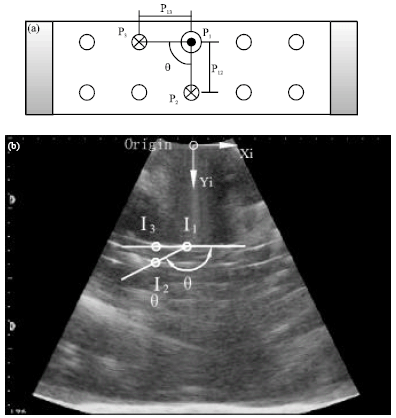 Image for - 3-D Calibration Algorithm for Freehand Ultrasound Image