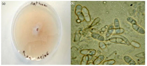 Image for - Characterization of Ascochyta as Pathological Species of Pea (Pisum sativum L.) at the North-West of Algeria