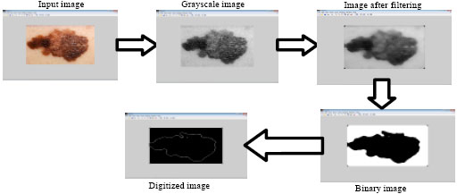 Image for - Asymmetry Analysis of Malignant Melanoma Using Image Processing: A Survey