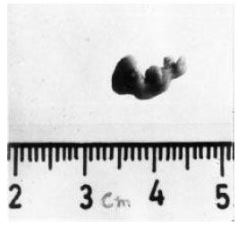 Image for - Toxic Effects of Cypermethrin on the Biochemistry and Morphology of 11th Day Chick Embryo(Gallus domesticus)