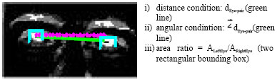 Image for - Detection of Pose and Scale Variant Human Faces in Color and Gray Images