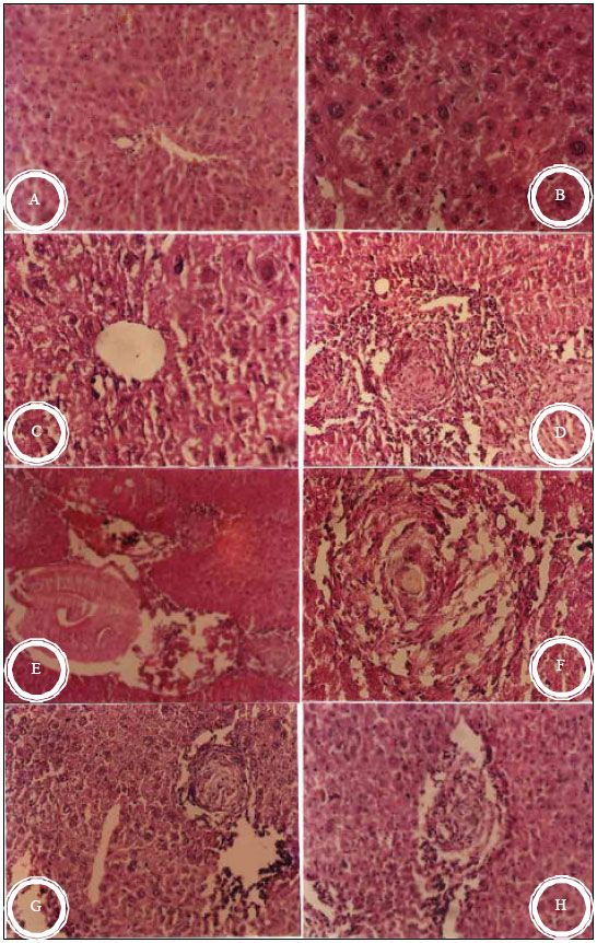 Image for - Effect of Ailanthus altissima and Zizyphus spina-christi on Bilharzial Infestation in Mice: Histological and Histopathological Studies