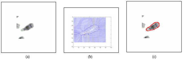 Image for - Boundary Mapping of Chromosome Spread Images Using Optimal Set of Parameter Values in Discrete Cosine Transform Based Gradient Vector Flow Active Contours