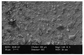 Image for - XRD and Surface Morphology Studies on Chitosan-Based Film Electrolytes