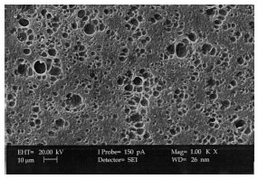 Image for - XRD and Surface Morphology Studies on Chitosan-Based Film Electrolytes