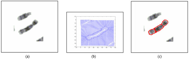 Image for - Boundary Mapping of Chromosome Spread Images Using Optimal Set of Parameter Values in Discrete Cosine Transform Based Gradient Vector Flow Active Contours