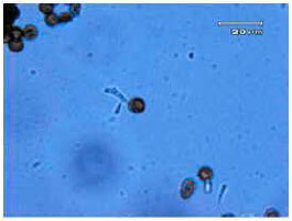 Image for - In vitro Detection of Yeast-Like and Mycelial Colonies of Ustilago scitaminea in Tissue-Cultured Plantlets of Sugarcane Using Polymerase Chain Reaction