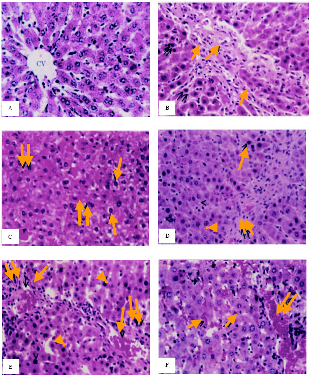 Image for - Antioxidant Activity and Hepatoprotective Potential of Black Seed,  Honey and Silymarin on Experimental Liver Injuries Induced by CCl4  in Rats