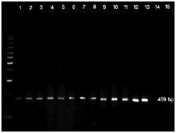 Image for - In vitro Detection of Yeast-Like and Mycelial Colonies of Ustilago scitaminea in Tissue-Cultured Plantlets of Sugarcane Using Polymerase Chain Reaction