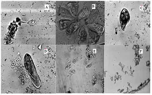Image for - Protozoan Fauna and Abundance in Aeration Tanks of Three Municipal Wastewater Treatment Plants in the Eastern Cape Province of South Africa