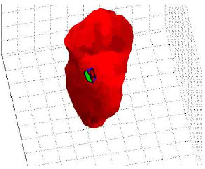 Image for - 3D Point Wise Tracking of the Left Ventricle over Cardiac Image Sequences Using Active Mesh and Physical Models