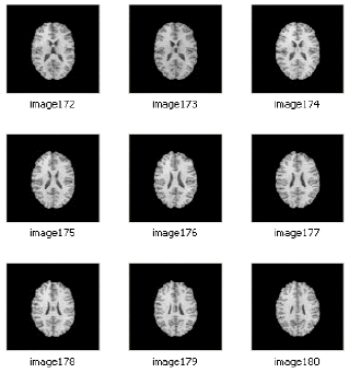 Image for - Medical Image Segmentation Using Enhanced Hoshen-Kopelman Algorithm