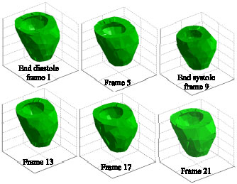 Image for - 3D Point Wise Tracking of the Left Ventricle over Cardiac Image Sequences Using Active Mesh and Physical Models