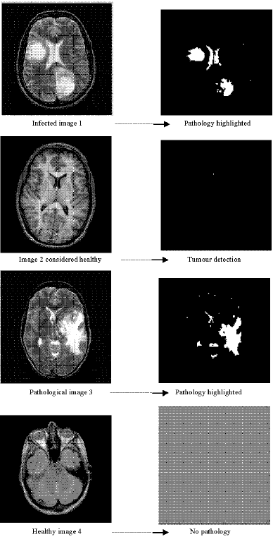Image for - Classification of the Medical Images by the Kohonen Network SOM and LVQ