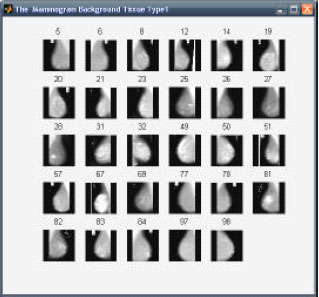 Image for - Neural Network and Genetic Algorithm Based Hybrid Model for Content Based Mammogram Image Retrieval