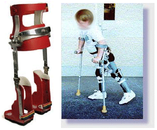 Image for - Hybrid Orthosis: The Technology for Spinal Cord Injury