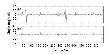 Image for - Maternal ECG Cancellation in Abdominal Signal Using ANFIS and Wavelets