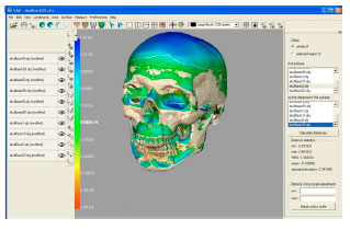 Image for - An Accurate Method to Obtain Bio-Metric Measurements for Three Dimensional Skull