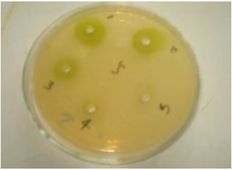 Image for - Anticandidal and Antistaphylococcal Activity of Soap Fortified with Ocimum gratissimum Extract