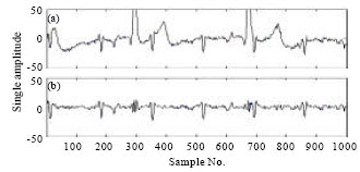 Image for - Maternal ECG Cancellation in Abdominal Signal Using ANFIS and Wavelets