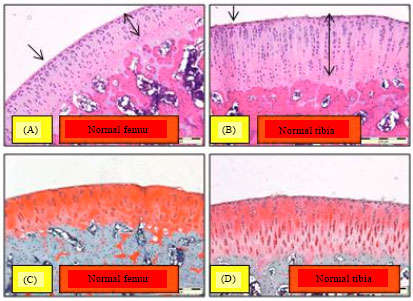 Image for - Chondroprotective Effect of Zerumbone on Monosodium Iodoacetate Induced Osteoarthritis in Rats
