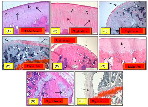 Image for - Chondroprotective Effect of Zerumbone on Monosodium Iodoacetate Induced Osteoarthritis in Rats
