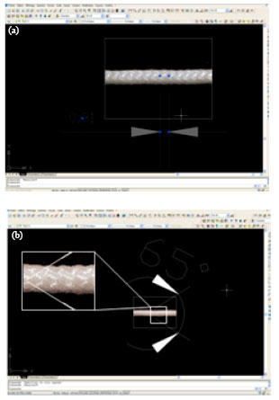 Image for - Effect of Braiding and Hot Stretching Conditions on Sutures Performances