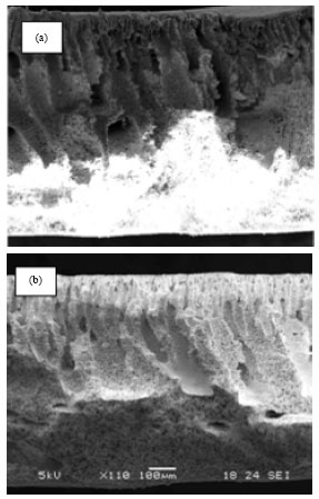 Image for - Effect of Kaolin/pesf Ratio and Sintering Temperature on Pore Size and Porosity of the Kaolin Membrane Support